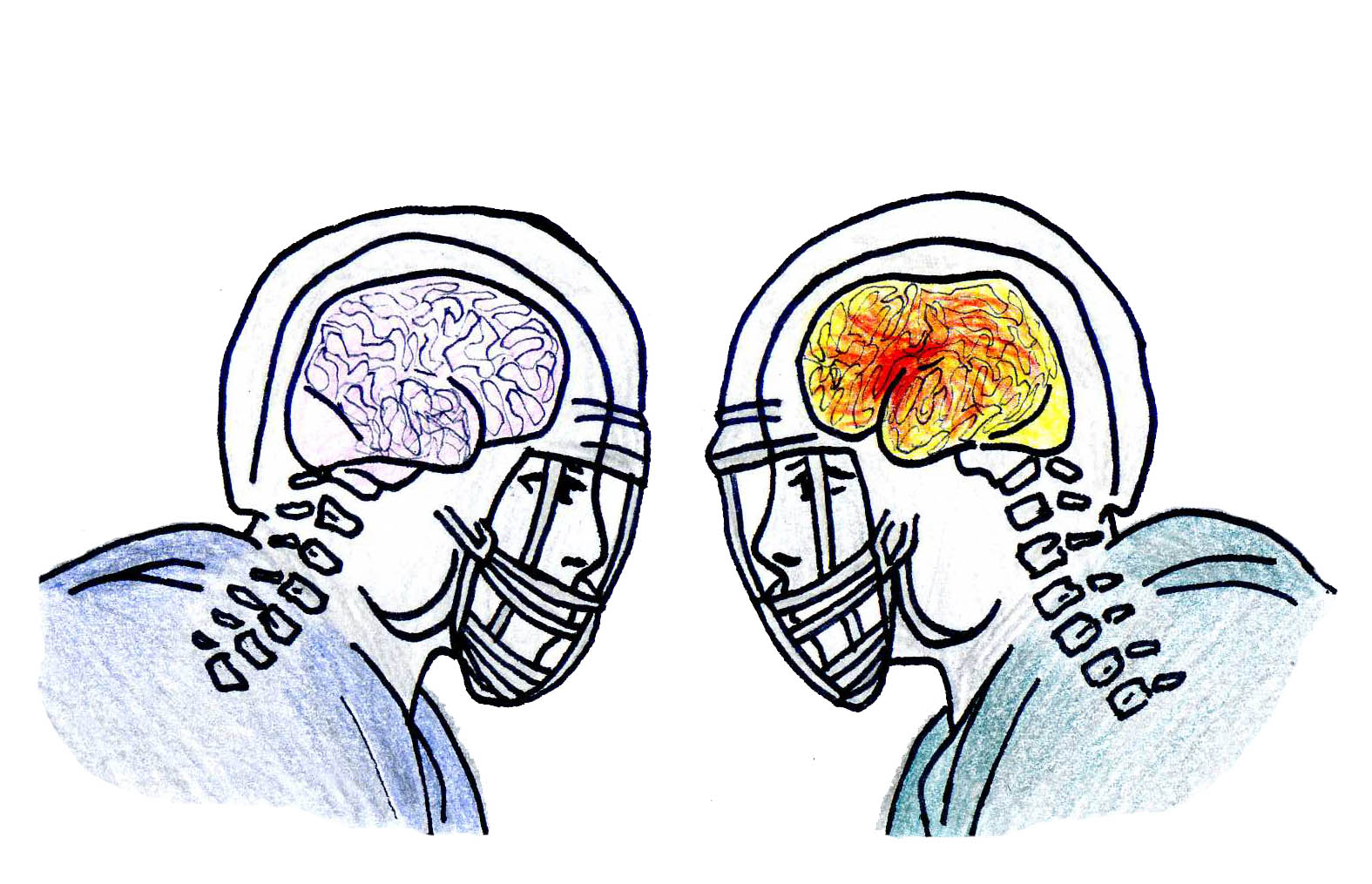 Concussions prove to be detrimental
